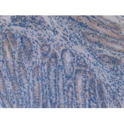 Activating Transcription Factor 1 (ATF1) Antibody