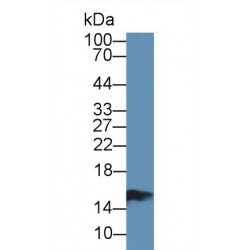 Fatty Acid-Binding Protein, Intestinal (FABP2) Antibody