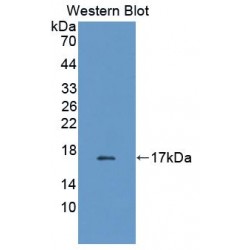 Fatty Acid-Binding Protein, Intestinal (FABP2) Antibody