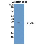 Western blot analysis of the recombinant protein.