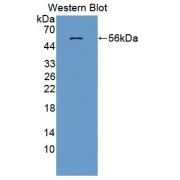 Western blot analysis of the recombinant protein.