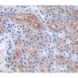 Phenylalanyl tRNA Synthetase 2, Mitochondrial (FARS2) Antibody