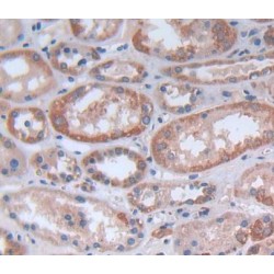 Fas Activated Serine/Threonine Kinase (FASTK) Antibody