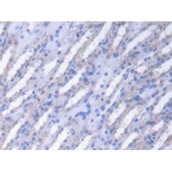 Fumarase (FUM) Antibody