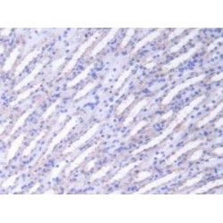 Fumarase (FUM) Antibody