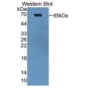 Western blot analysis of the recombinant protein.