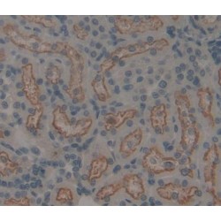 Flavin Containing Monooxygenase 2, Non Functional (FMO2) Antibody