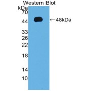 Western blot analysis of the recombinant protein.