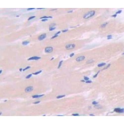 Adiponectin (ADIPOQ) Antibody