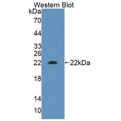 Glutaryl Coenzyme A Dehydrogenase (GCDH) Antibody