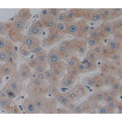 Glutaryl Coenzyme A Dehydrogenase (GCDH) Antibody