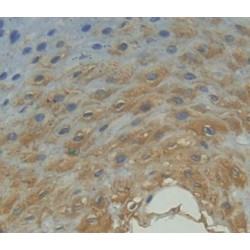 Fucose-1-Phosphate Guanylyltransferase (FPGT) Antibody