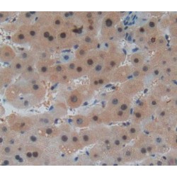 Hexokinase-4 (GCK) Antibody