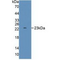 Glutamate Receptor, Ionotropic, AMPA 3 (GRIA3) Antibody