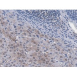 Autocrine Motility Factor Receptor (AMFR) Antibody