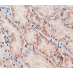 Autocrine Motility Factor Receptor (AMFR) Antibody