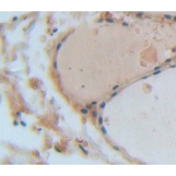 Angiogenic Factor With G Patch And FHA Domains 1 (AGGF1) Antibody