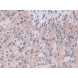 Glucocorticoid Receptor (NR3C1) Antibody