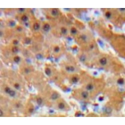 Glucocorticoid Receptor (NR3C1) Antibody