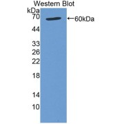 Western blot analysis of the recombinant protein.