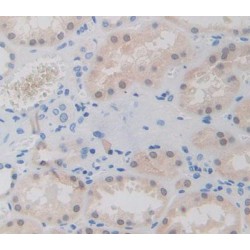 General Transcription Factor IIA, Polypeptide 1 (GTF2A1) Antibody