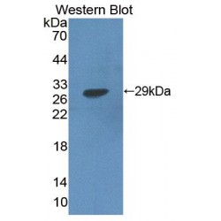 Hydroxyacyl Coenzyme A Dehydrogenase (HADH) Antibody