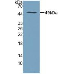 Serine Peptidase Inhibitor Kunitz Type 2 (SPINT2) Antibody