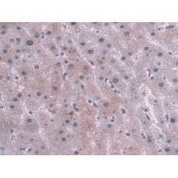 Serine Peptidase Inhibitor Kunitz Type 2 (SPINT2) Antibody