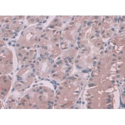 Serine Peptidase Inhibitor Kunitz Type 2 (SPINT2) Antibody