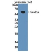 Western blot analysis of the recombinant protein.