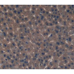 Eukaryotic Translation Initiation Factor 2D (EIF2D) Antibody