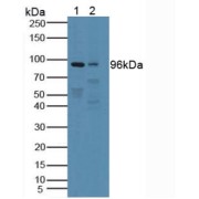 Western blot analysis of (1) Human Blood Cells and (2) Rat Brain Tissue.