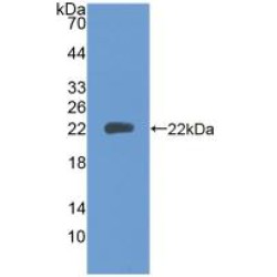 Protein Tyrosine Phosphatase Receptor Type N (PTPRN) Antibody