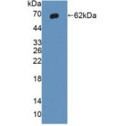 Western blot analysis of recombinant Human IkBKb.