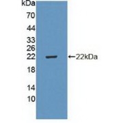 Western blot analysis of recombinant Human CDKN2D.