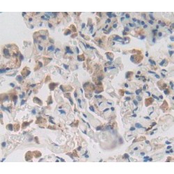 Cyclin Dependent Kinase Inhibitor 2D (CDKN2D) Antibody