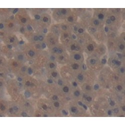 E1A Binding Protein P300 (EP300) Antibody