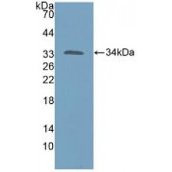 Katanin P60 Subunit A 1 (KATNA1) Antibody