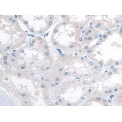 Katanin P60 Subunit A 1 (KATNA1) Antibody