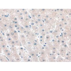 Katanin P60 Subunit A 1 (KATNA1) Antibody