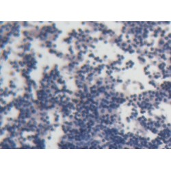 Acid Phosphatase 6, Lysophosphatidic (ACP6) Antibody