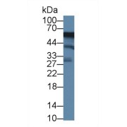 Western blot analysis of Human K562 cell lysate, using Mouse ACP6 Antibody (1 µg/ml) and HRP-conjugated Goat Anti-Rabbit antibody (<a href="https://www.abbexa.com/index.php?route=product/search&amp;search=abx400043" target="_blank">abx400043</a>, 0.2 µg/ml).