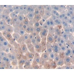 Acid Phosphatase 6, Lysophosphatidic (ACP6) Antibody