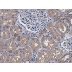 Luc7-Like Protein 3 (LUC7L3) Antibody