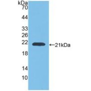 Western blot analysis of recombinant Rat GaA.