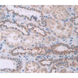 Lysosomal Alpha Glucosidase (GAA) Antibody