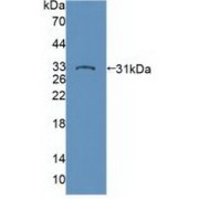 Western blot analysis of recombinant Human PTPN22.