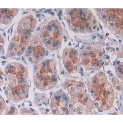 Protein Tyrosine Phosphatase, Non Receptor Type 22 (PTPN22) Antibody