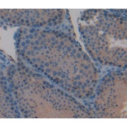 Interleukin 3 (IL3) Antibody