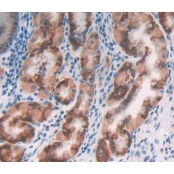 Molybdenum Cofactor Synthesis 1 (MOCS1) Antibody